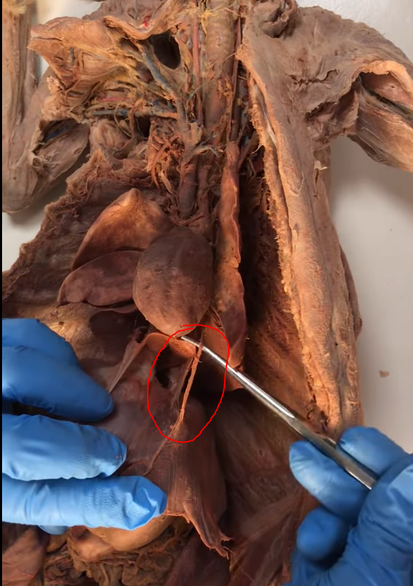 <p>What is this nerve that is on the diaphragm</p>
