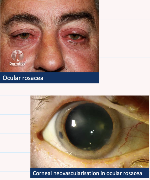 <p>Describe and give diagnosis</p>