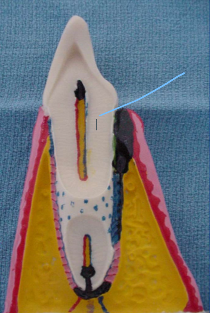 <p>This internal structure is the </p>