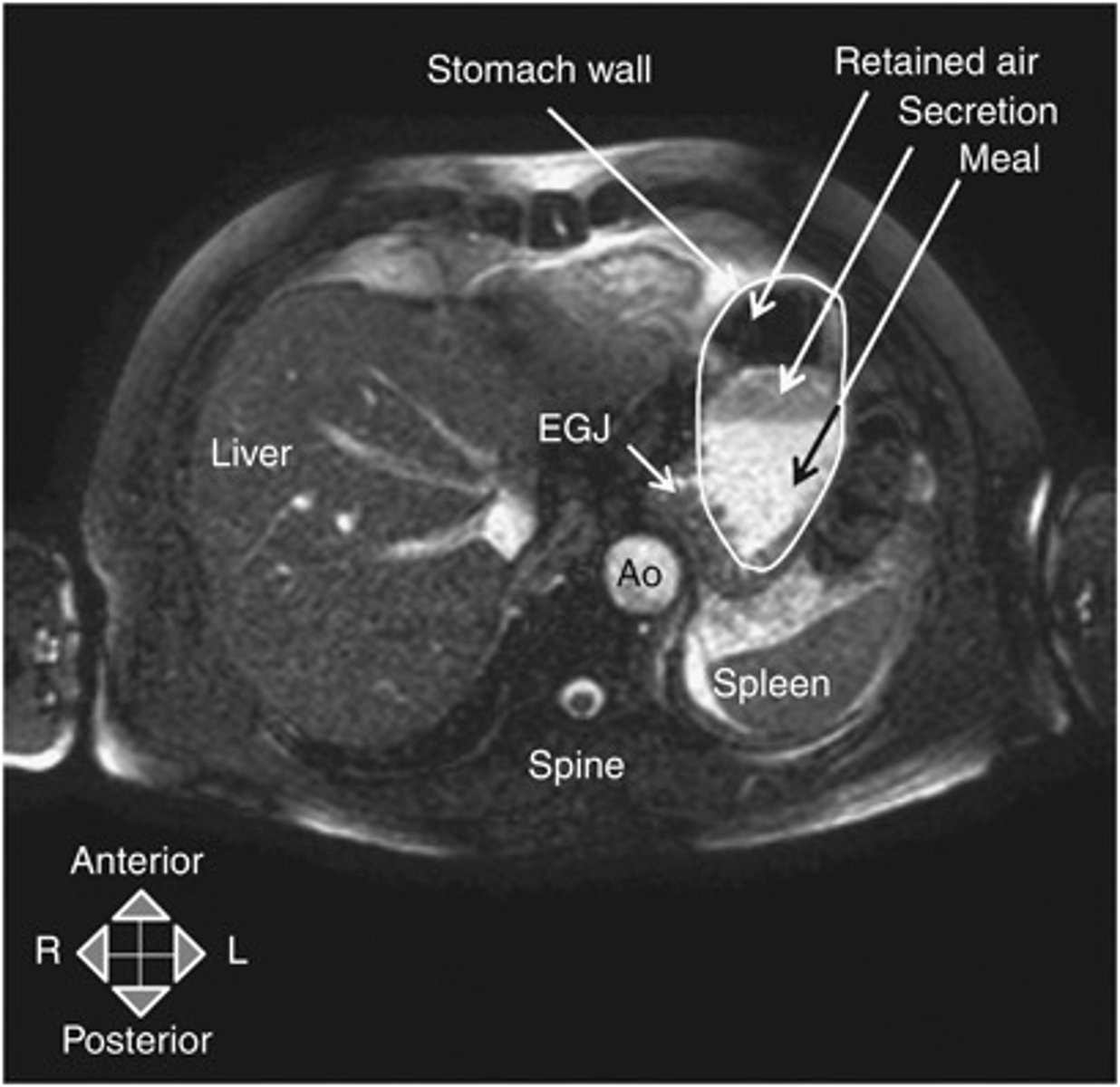 <p>abdominal magnetic resonance imaging (MRI)</p>