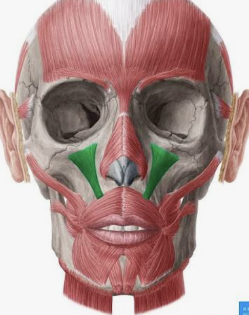 <p>Which muscle is this?</p>