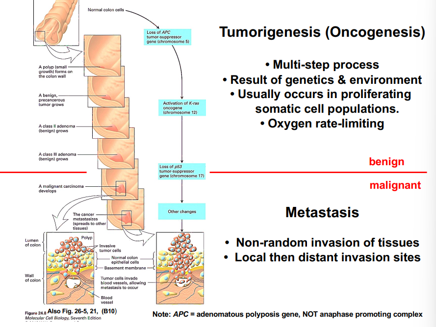 <p><span style="background-color: transparent;"><strong>Benign vs. Malignant Tumors</strong></span></p>