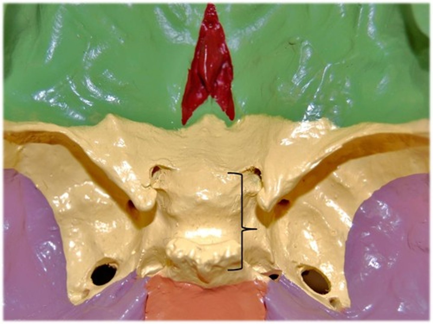 <p>small depression of the sphenoid bone that contains the pituitary gland</p>