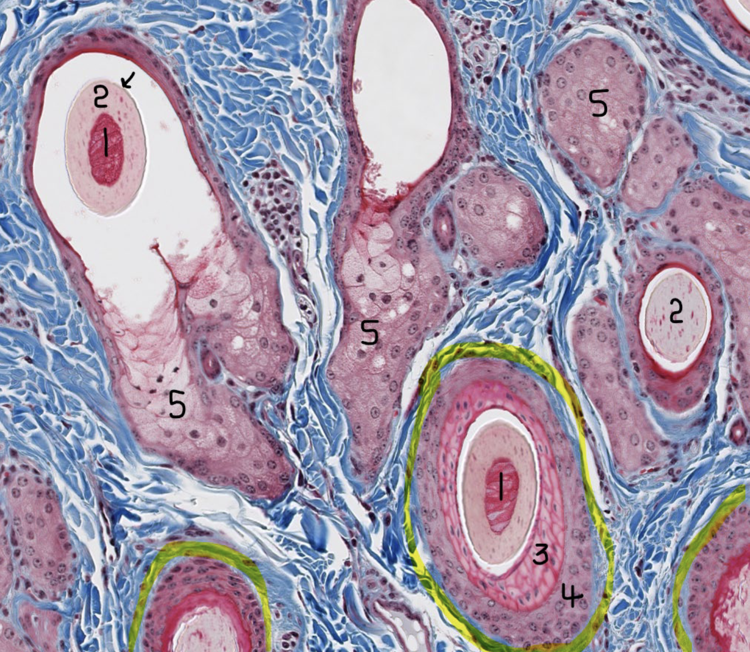 <p>Image of haired skin, what is 3?</p>