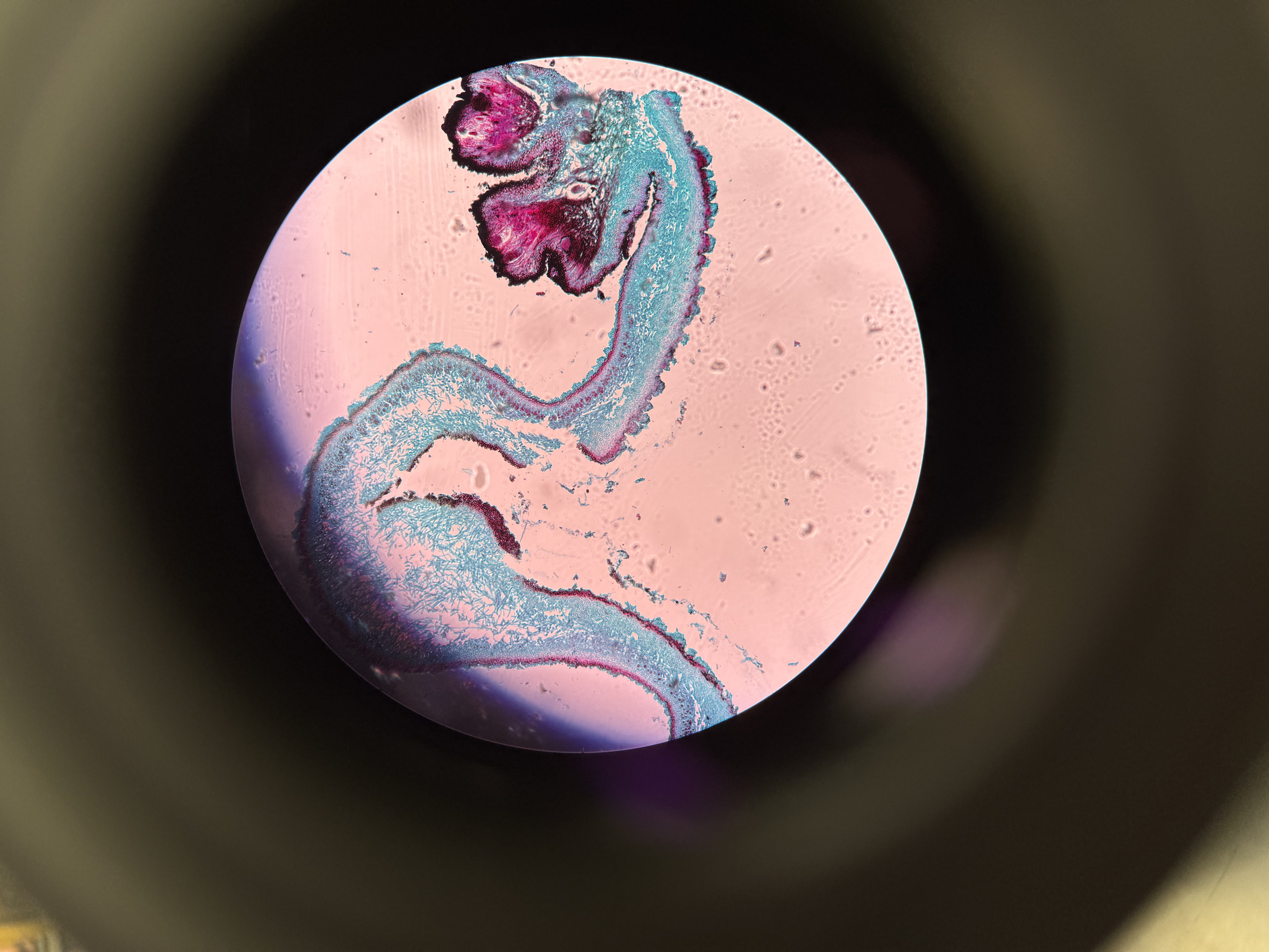 <ol><li><p>What is this?</p></li><li><p>What phylum?</p></li><li><p>Spore location?</p></li><li><p>Where is the upper cortex?</p></li><li><p>Where is the middle photosynthetic cells (algal zone)</p></li><li><p>Where is the lower cortex?</p></li></ol><p></p>