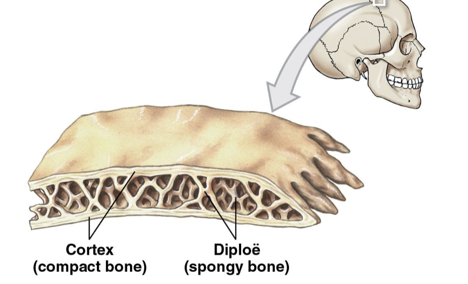 <p>– Made of spongy bone between two layers of compact bone; <strong>cortex</strong></p><p>– Layer of spongy bone is called the <strong>diploë</strong></p><p><strong>cortex→ diploë→cortex (bone sandwhich) </strong></p><p>ex: parietal bones of skull</p>