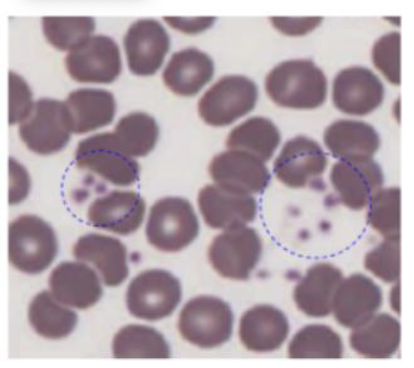 <p>What is circled?</p>