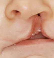 <p>extends to the nostril </p>