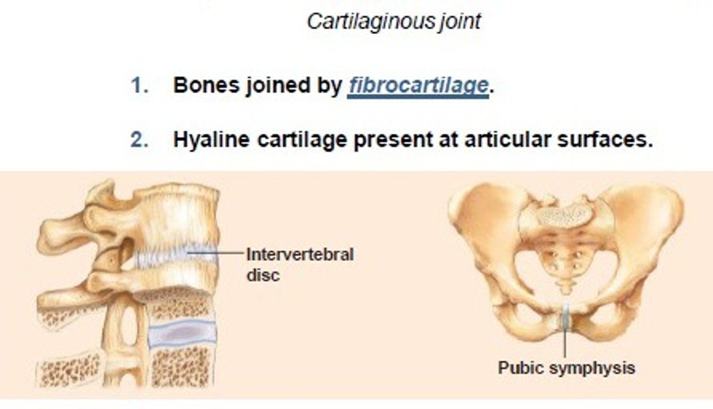 <p>A joint in which the bones are connected by fibrocartilage</p>