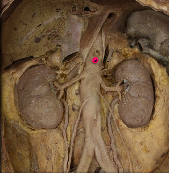 <p>(No branches)</p>