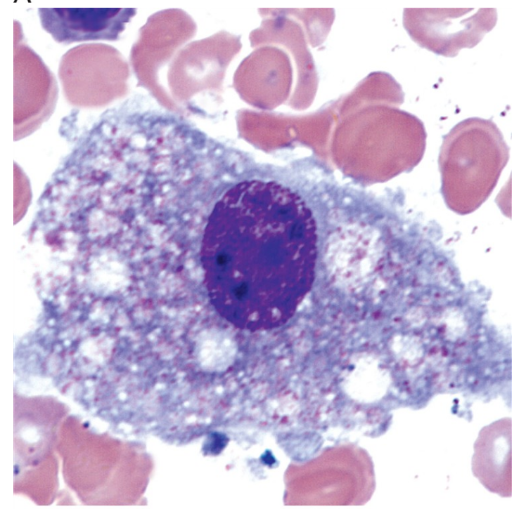 <p>what is a macrophage?</p>