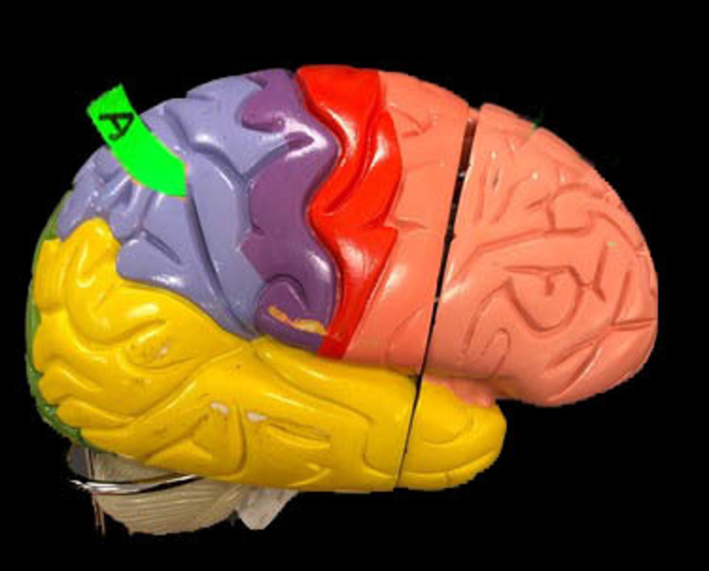 <p>Identify this lobe.</p>