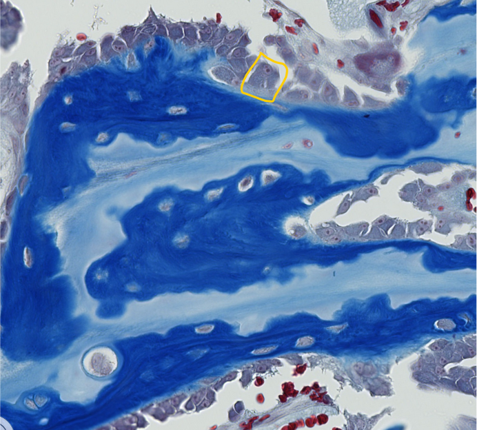 <p><span style="font-family: "Calibri Light";">What is the name of the <u>unmineralized</u> matrix of collagen type I & proteoglycans secreted by the encircled bone cell?</span></p>