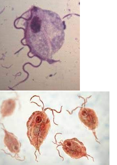 <p><em>(Penta)trichomonas hominis</em> is a ___ that is ___ (non or patho).</p><p><strong>Infective form:</strong> ___ associated with ___ contamination</p><p></p><p><strong>Body site where infection occurs:</strong> nonpathogenic, but may colonize the ___ intestine</p><p><strong>Cysts: </strong>LACKS cyst form!</p><p><strong>Trophs:</strong></p><ul><li><p>___ anterior flagella</p></li><li><p>Undulating membrane - extends the ___ of organism</p></li></ul><p></p>