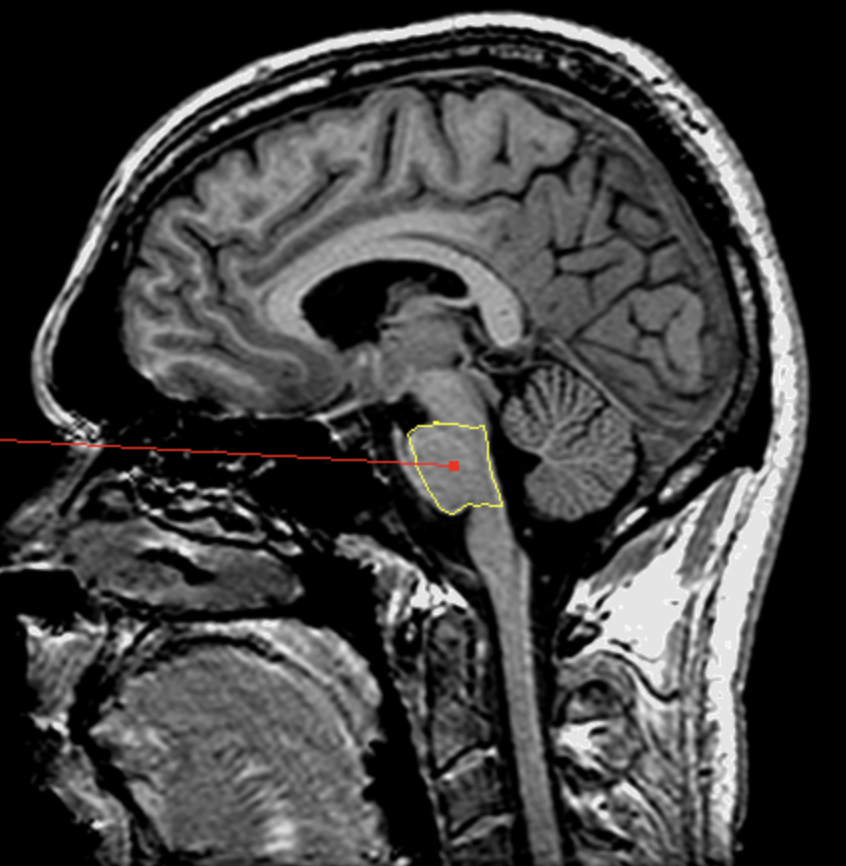 <p>What is the area highlighted called?</p>