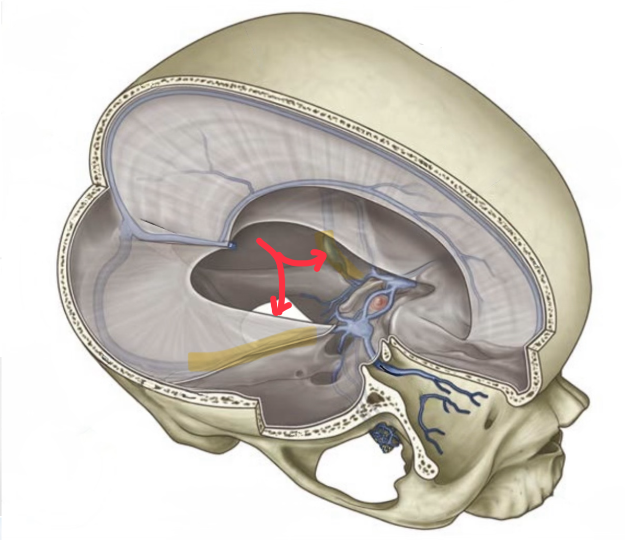 term image