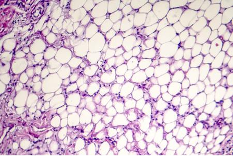 <p> what tissue is this?</p>