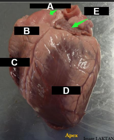 <p>Two atria and two ventricles</p><p>Atria are the blood-receiving chambers</p><p>Ventricles are the blood-pumping chambers</p><p>The auricle is blind ear-shaped pouch of the atrium</p>