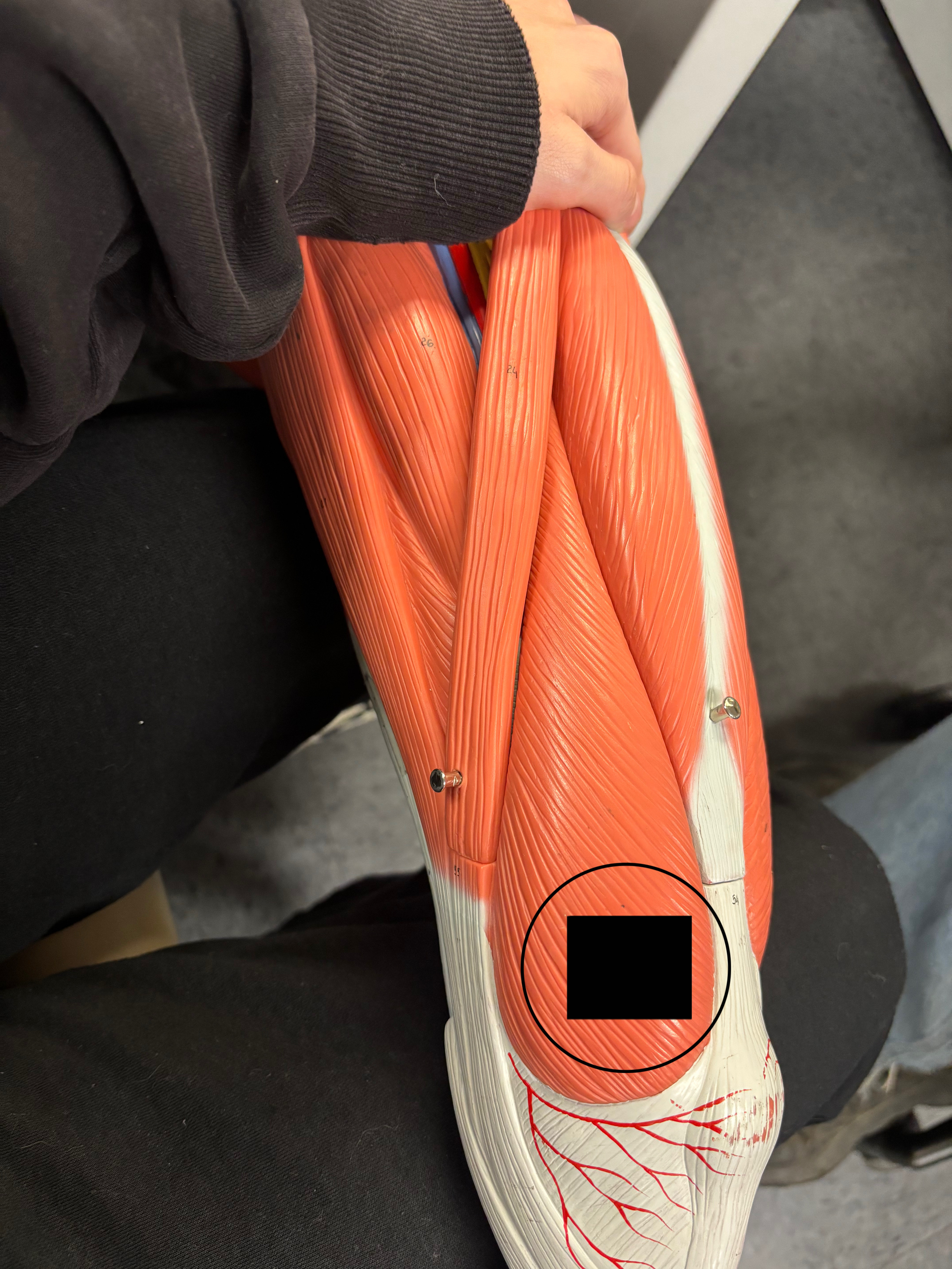 <p>What muscle is this and what is its action?</p>