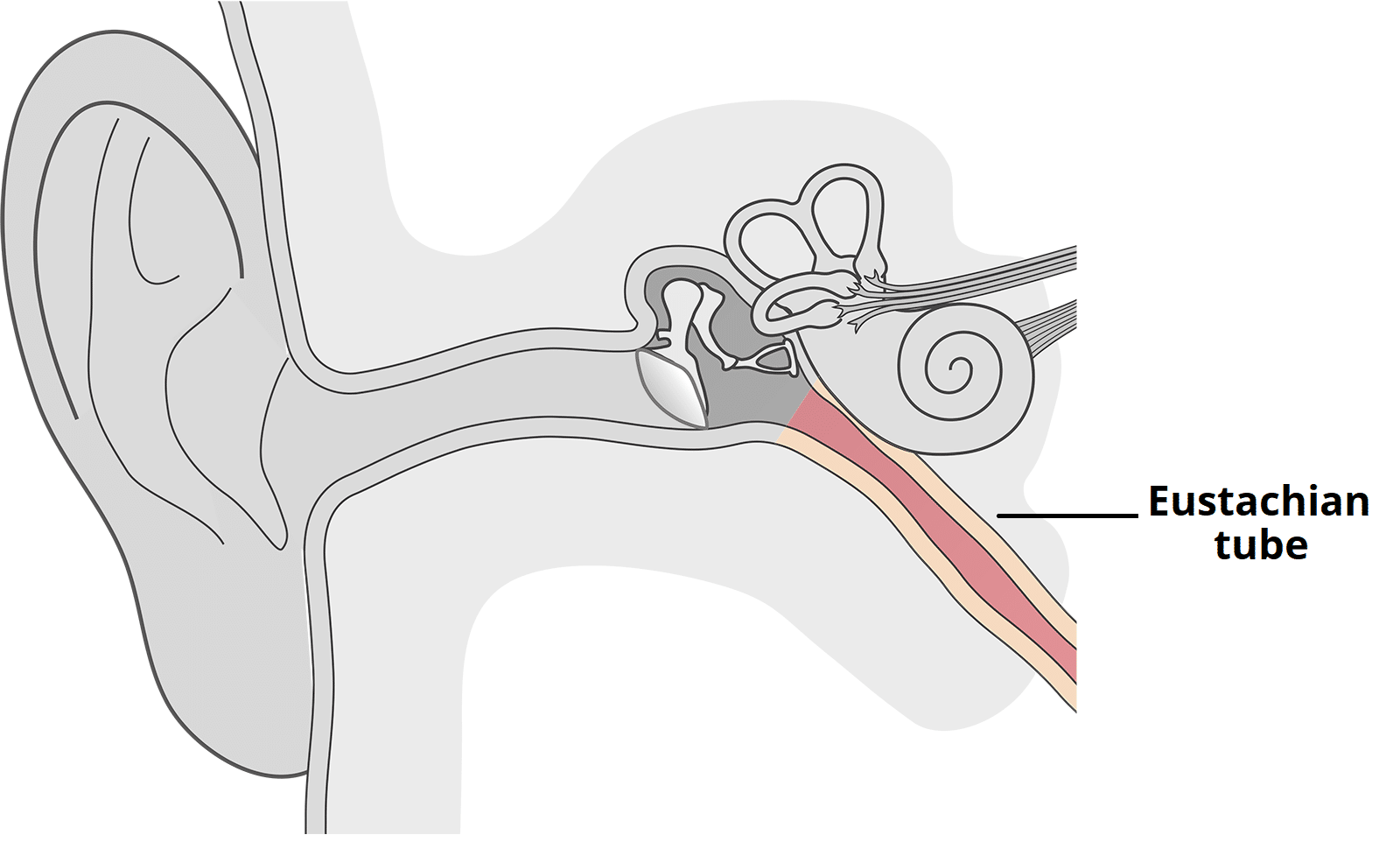 <p>Can cause tissues surrounding the eustachian tube to swell up, blocking it</p><p>The air in the middle ear is absorbed into the surrounding tissues</p><p>A vacuum forms in the middle ear</p><p>Fluid accumulates</p><p>Leads to glue ear</p>