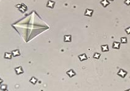 <p>Calcium Oxalate-Dihydrate Crystals</p>