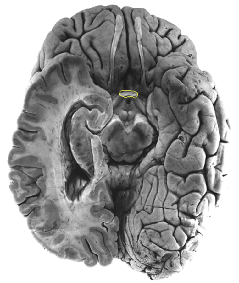 <p>What is the area highlighted called?</p>
