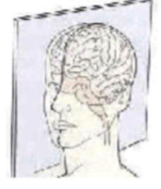 <p>slice orientation</p>