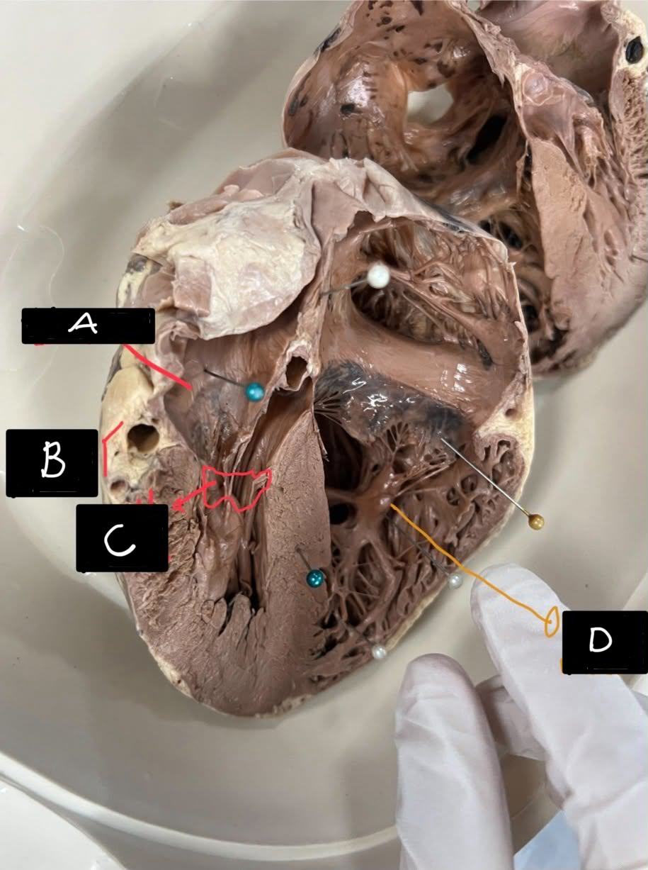 <p>Identify A</p>