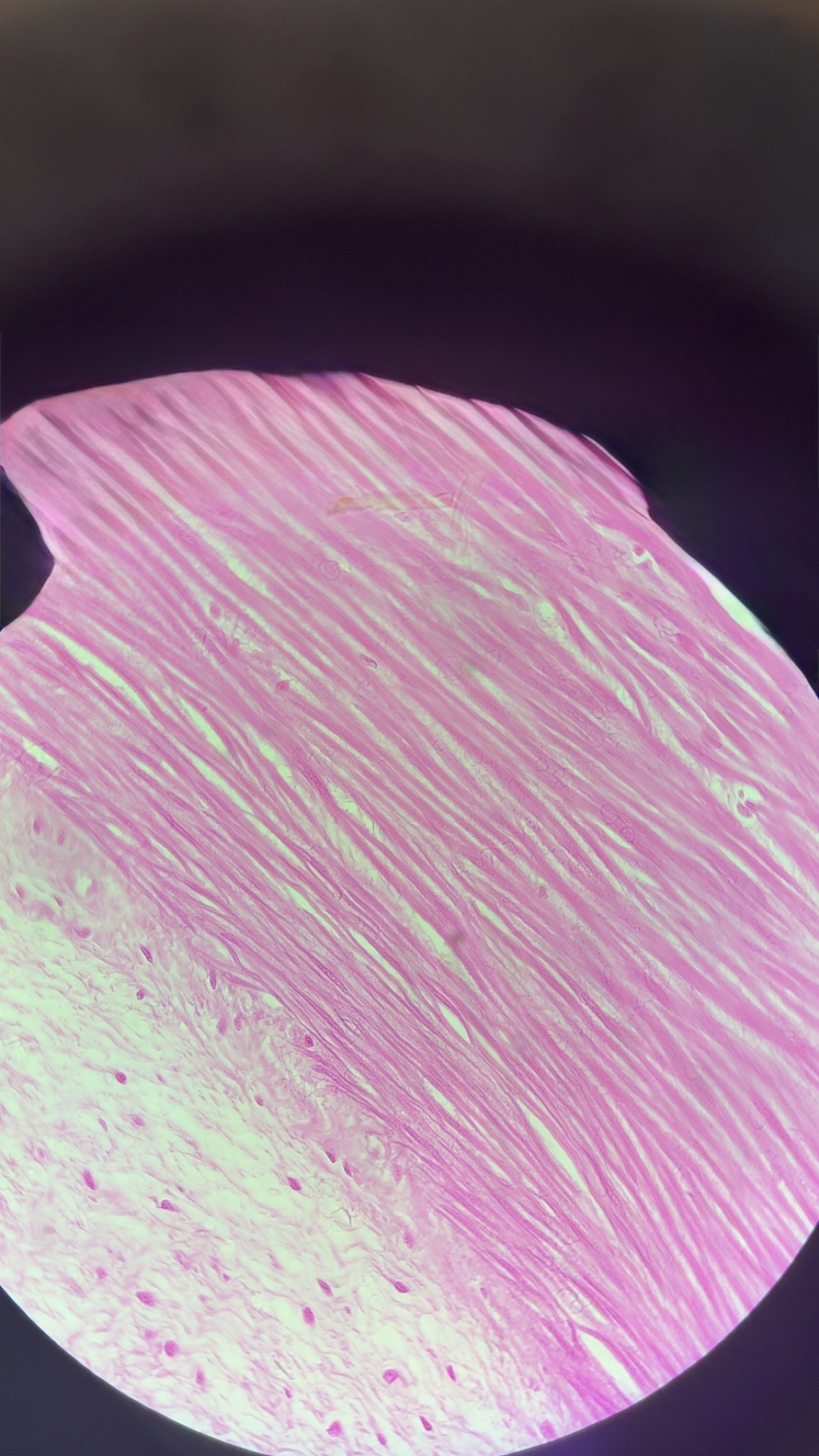 <p>what kind of muscle </p>