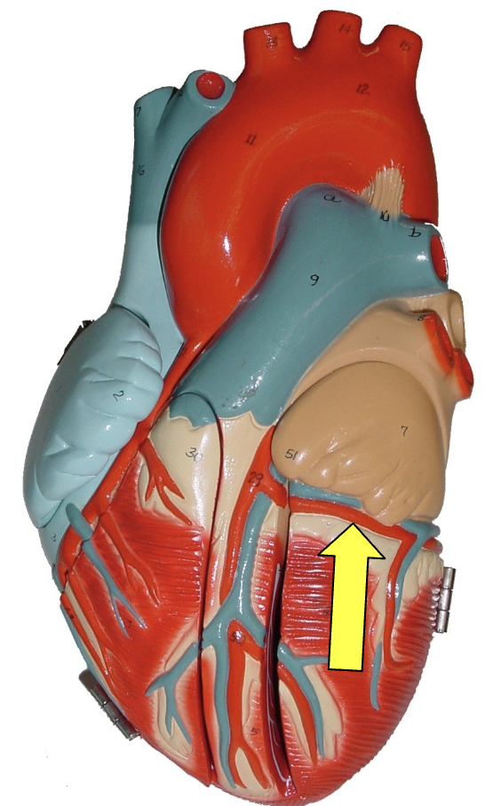 <p>what part of the heart muscle is shown?</p>