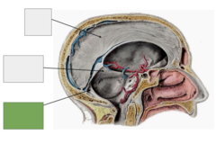 <p>This is the</p>