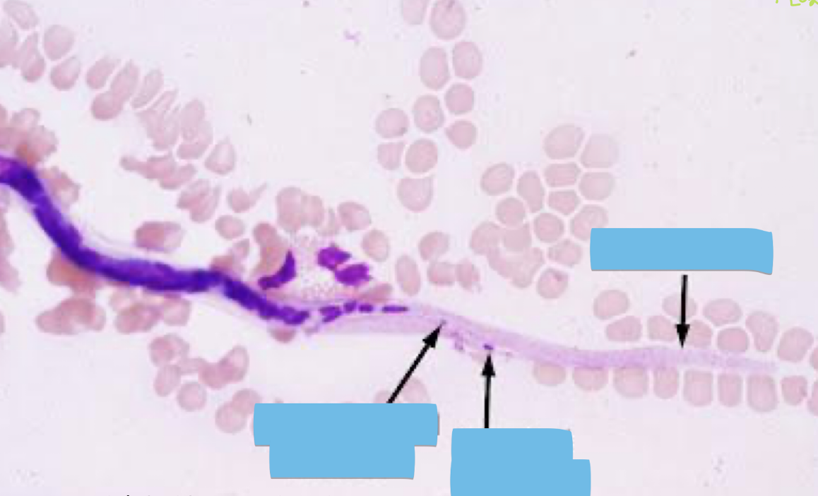 <p>What parasite is this?</p>