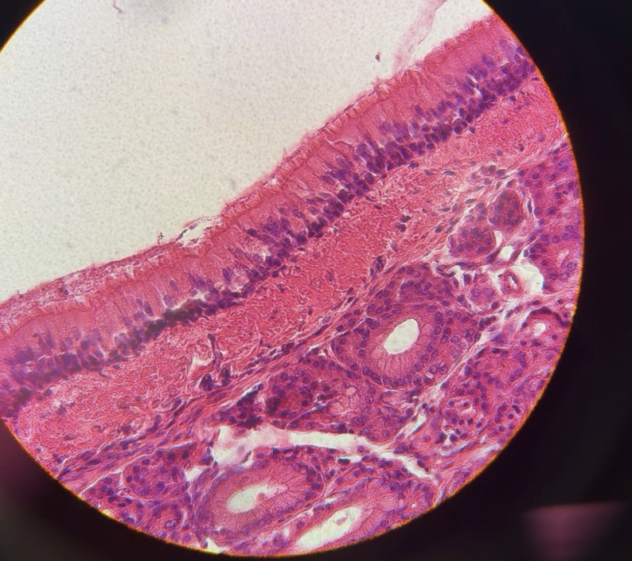 <ul><li><p><strong><u>Description</u></strong>: Single layer of cells of differing heights, some not reaching the free surface; nuclei seen at different levels; may contain mucus-secreting cells and bear cilia.</p></li></ul><p></p><ul><li><p><strong><u>Function</u></strong>: Secrete substances, particularly mucus; propulsion of mucus by ciliary action.</p></li></ul><p></p><ul><li><p><strong><u>Location</u></strong>: trachea, upper respiratory tract, sperm-carrying ducts and ducts of large glands.</p></li></ul><p></p>