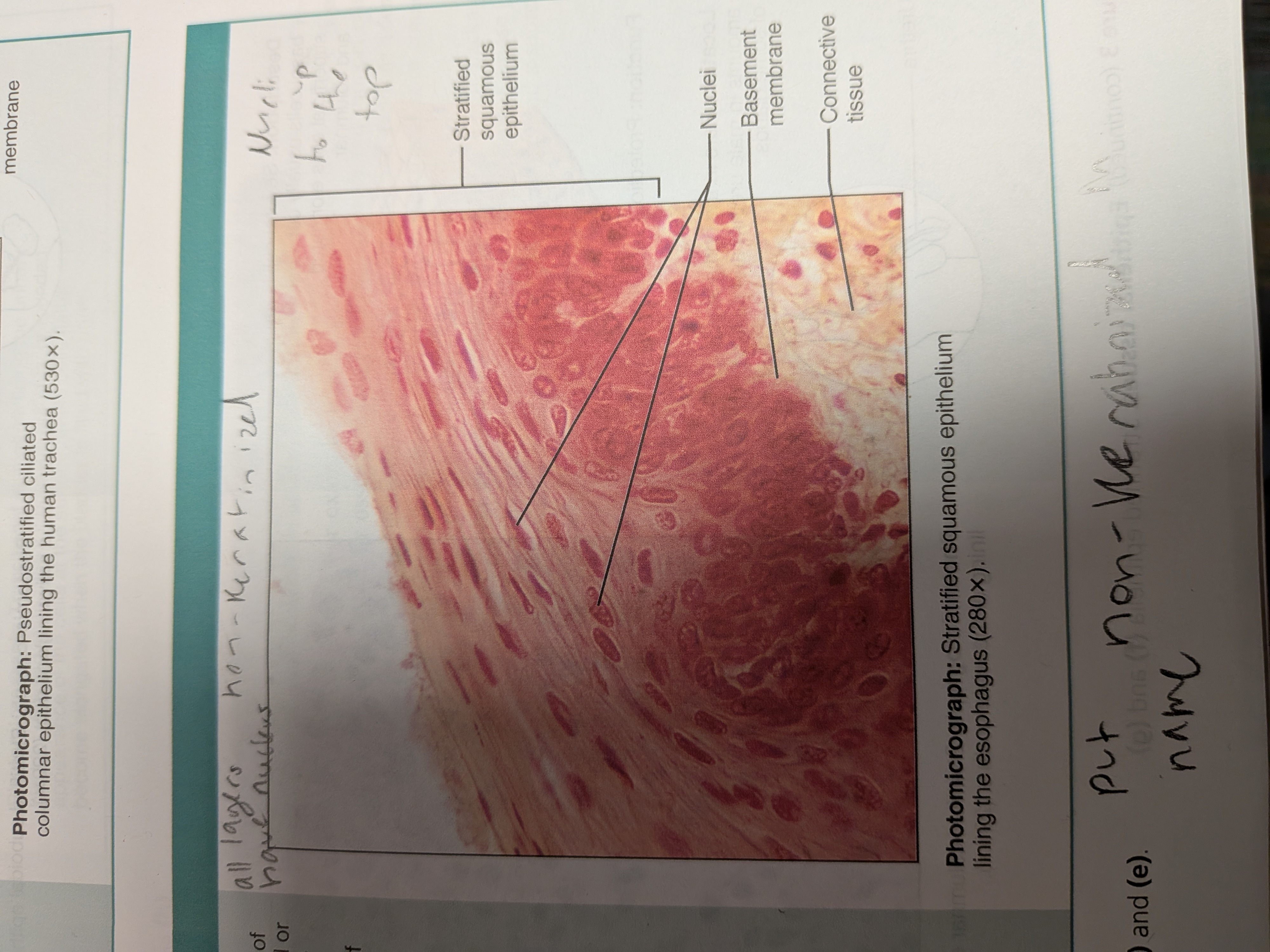<p>stratified squamous epithelium</p>
