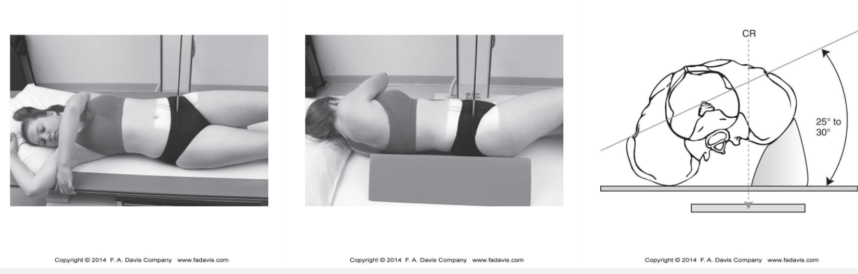<p>What is visualized on an oblique sacroiliac radiograph? </p>