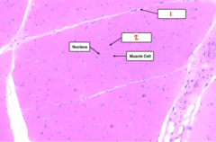<p>What part of skeletal muscle is labeled 1?</p>
