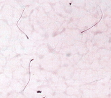 <p>Pinhead sperm</p>