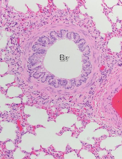 <p>identify the epithelium of the bronchiole </p>