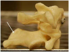 <p>Name this specific part of the axis (C2).</p>