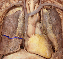 <p>Identify the structure</p>