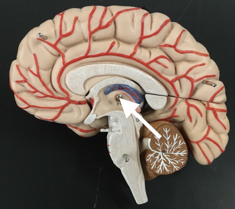 <p>What is the arrow pointing to?</p>