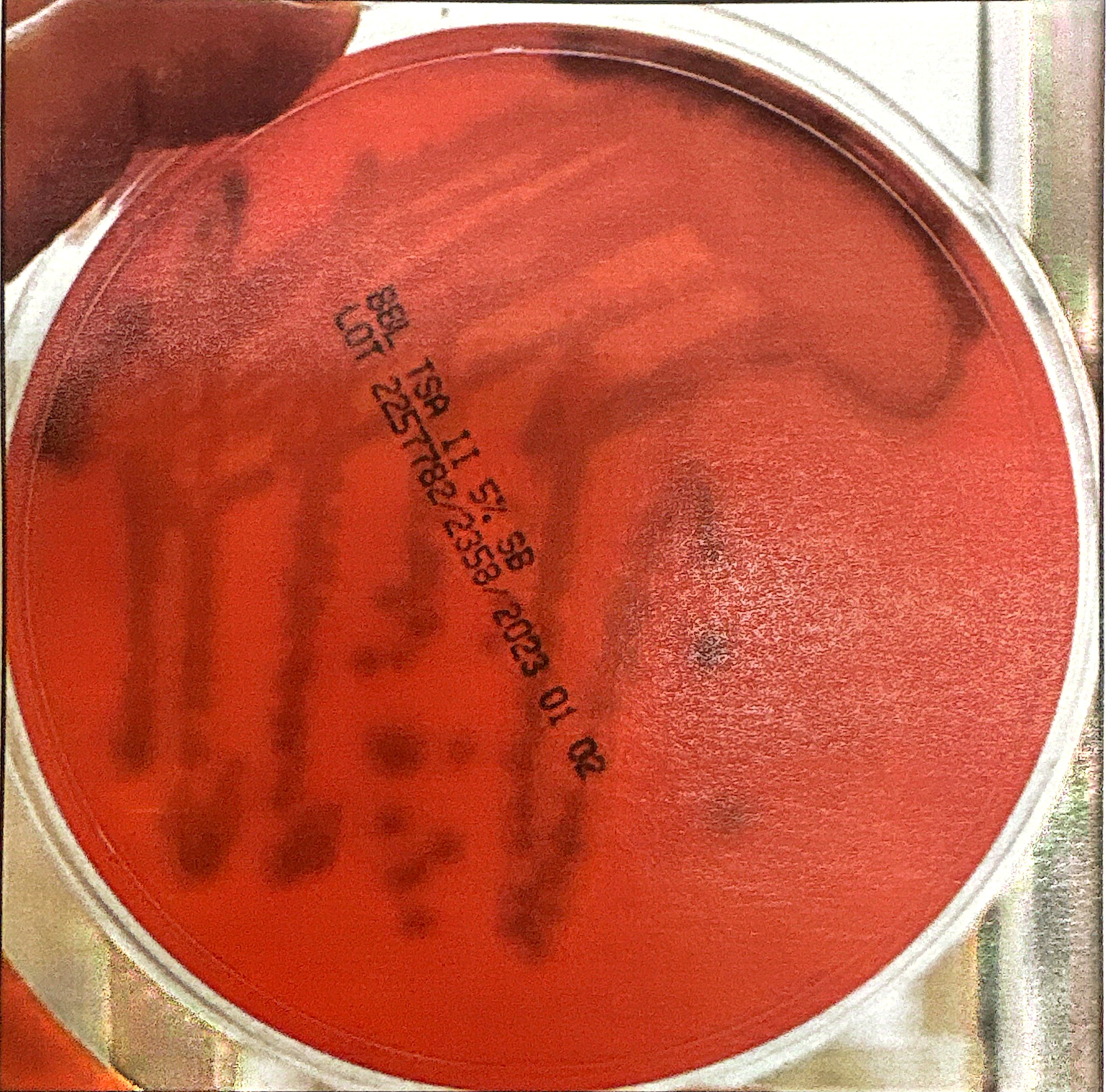 <p>produced by strep when the bacteria produce substances that oxidize the hemoglobin in red blood cells, turning the agar to a greenish brown.</p><p>Possessed by <em>S. pneumoniae </em></p>
