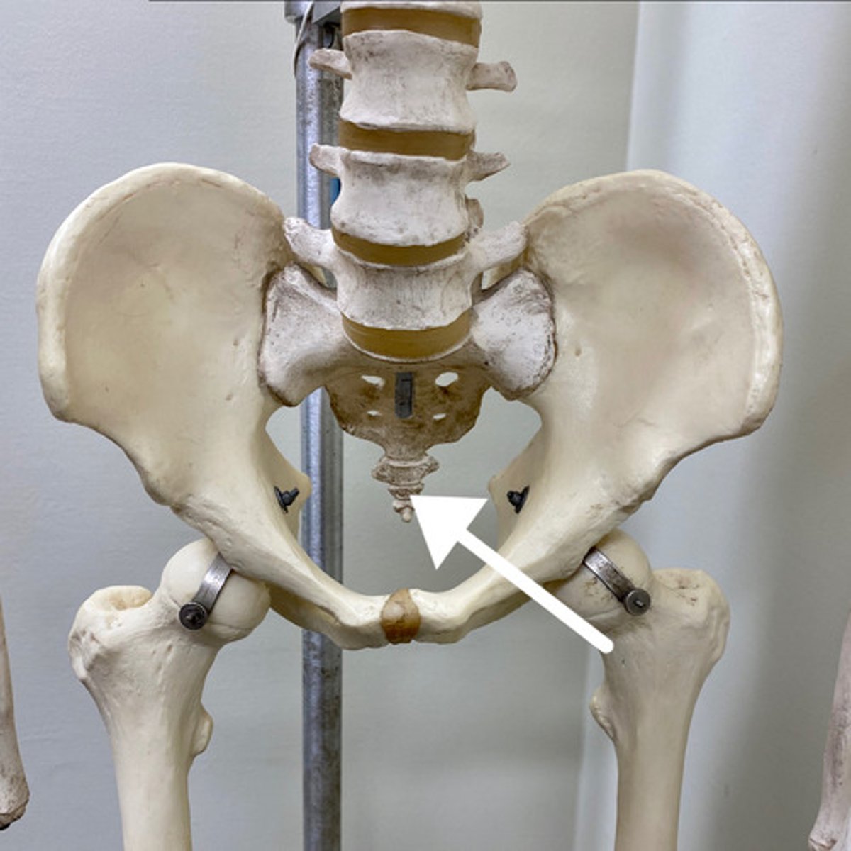 <p>What is this bone?</p>