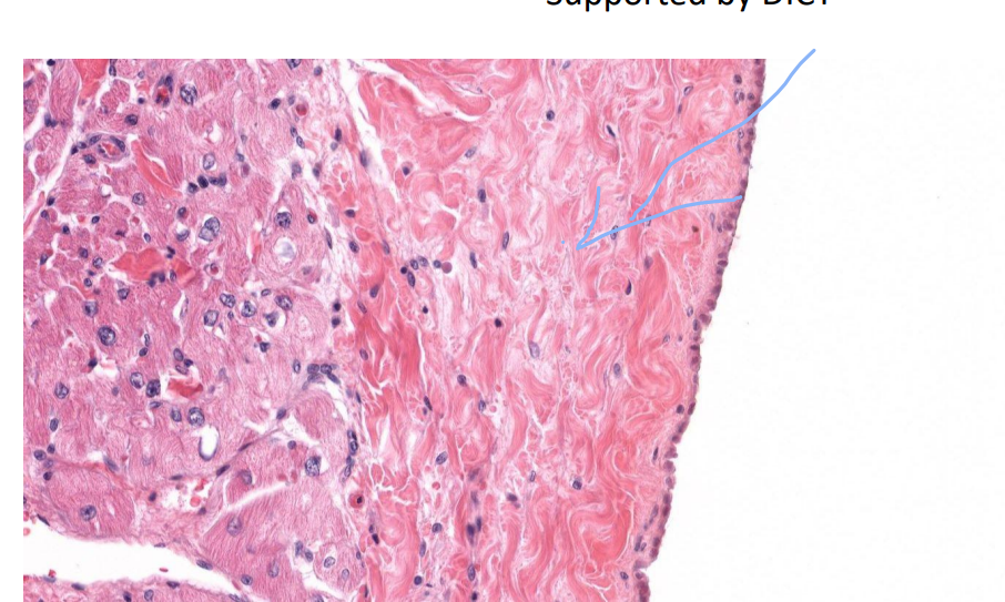 <p>Identify the structure and the tissue indicated by the arrow</p>