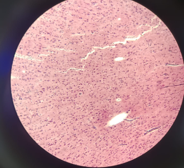 <p>Cerebrum - Fuschin</p>