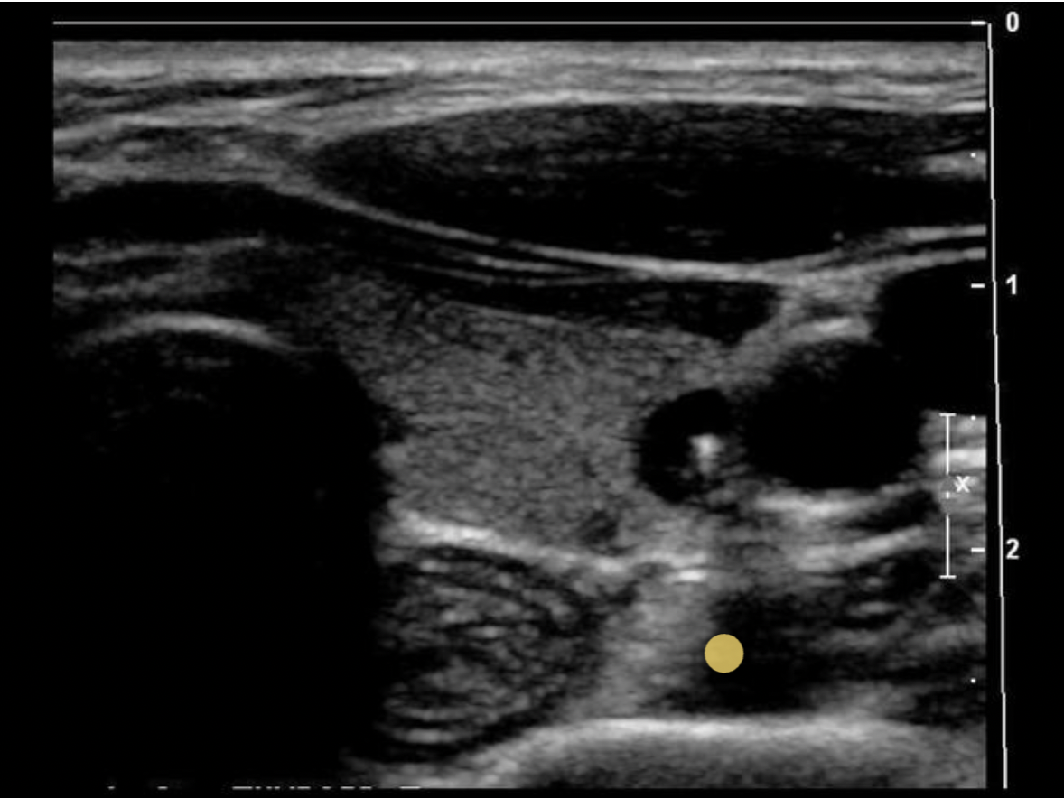 <p>The longus colli muscles are posterior to the thyroid gland</p>