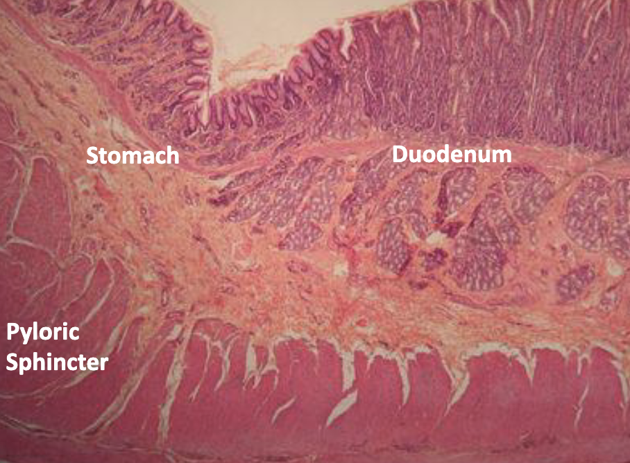 <p>stomach / duodenum junction: stomach region, duodenum region, pyloric sphincter, villi</p>