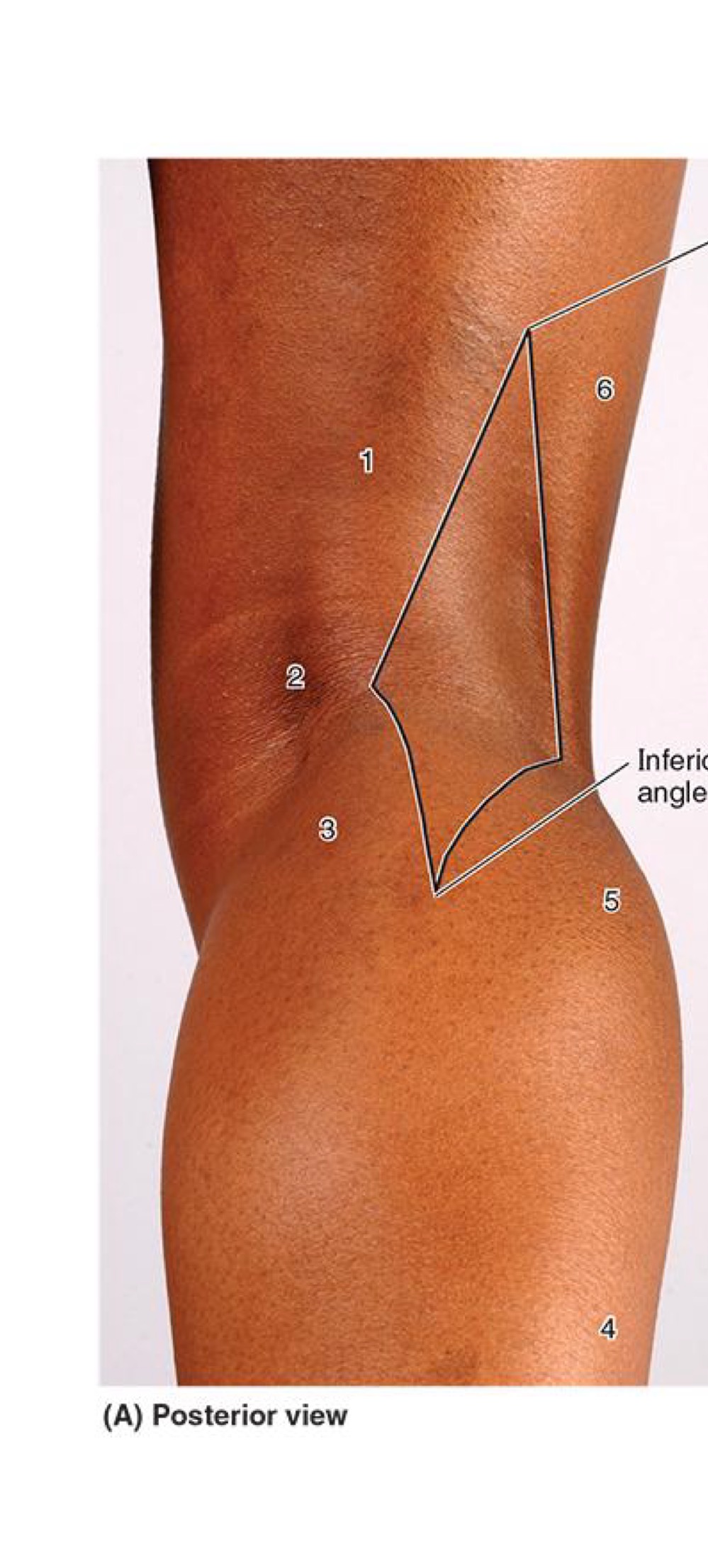 <ul><li><p><strong>Diamond-shaped depression POST KNEE joint</strong></p></li></ul><p></p><ul><li><p><strong>Borders:</strong></p><ul><li><p><strong>Superomedial → Semimembranous & Semitendinous m.</strong></p></li><li><p><strong>Superolateral → Biceps Femoris m.</strong></p></li><li><p><strong>Inferomedial → Medial Head of Gastrocnemius</strong></p></li><li><p><strong>Inferolateral → Lateral head of Gastrocnemius</strong></p></li><li><p><strong>Posterior (roof) → Popliteal fascia</strong></p></li><li><p><strong>Floor → Supracondylar Lines of Femur, POST KNEE joint + Popliteus m.</strong></p></li></ul></li></ul><p></p>