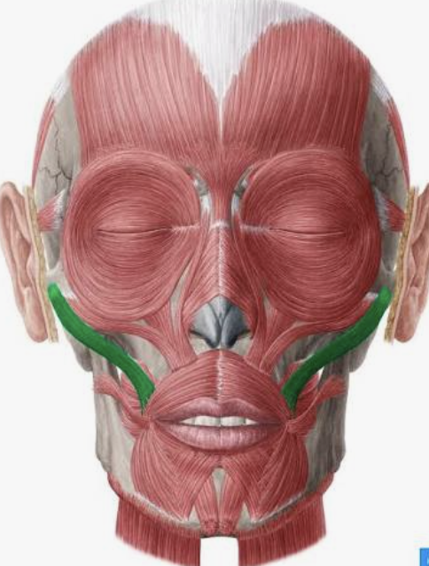 <p>Which muscle is this?</p>