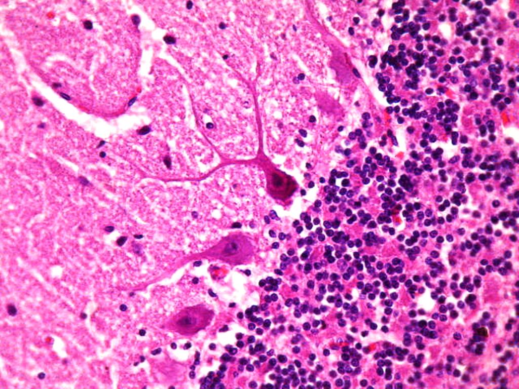 <p>Identifica la plaquita</p>